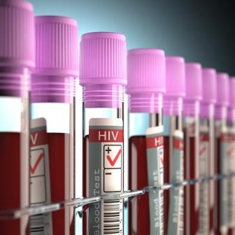HIV Postive Blood Sample